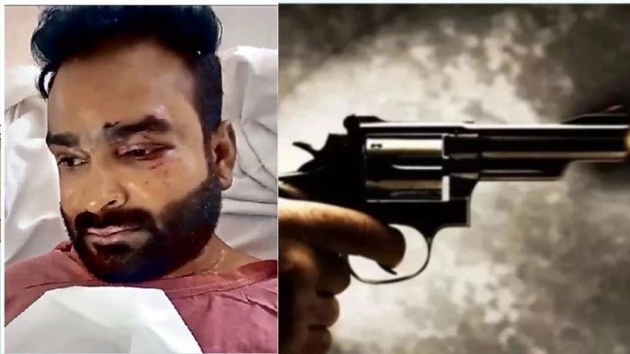 भोपाल के सागर रॉयल होम्स में देर रात फायरिंग; सरपंच के पैर में लगी गोली, तीनों आरोपी गिरफ्तार