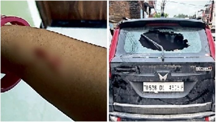 महाकाल दर्शन के लिए आए नोएडा के कारोबारी परिवार पर हमला; पार्किंग के नाम पर मारपीट और चाकूबाजी