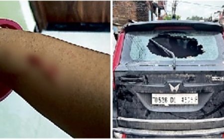 महाकाल दर्शन के लिए आए नोएडा के कारोबारी परिवार पर हमला; पार्किंग के नाम पर मारपीट और चाकूबाजी