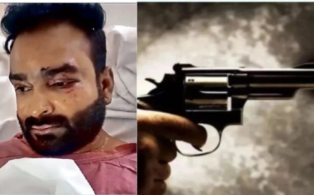 भोपाल के सागर रॉयल होम्स में देर रात फायरिंग; सरपंच के पैर में लगी गोली, तीनों आरोपी गिरफ्तार