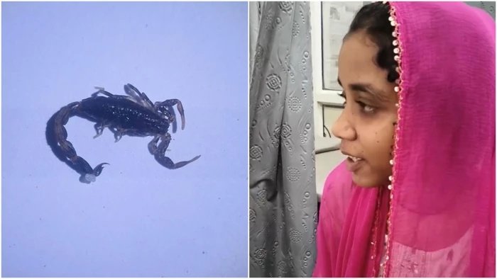 आदिवासी बालिका के कान में घुसा जिंदा बिच्छू, एक घंटे तक तड़पती रही किशोरी, डॉक्टर ने ऐसे बचाई जान