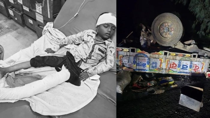 मंदसौर में मिनी ट्रक ने ट्रैक्टर-ट्रॉली को मारी टक्कर; बच्ची और महिला की मौत, 17 मजदूर घायल