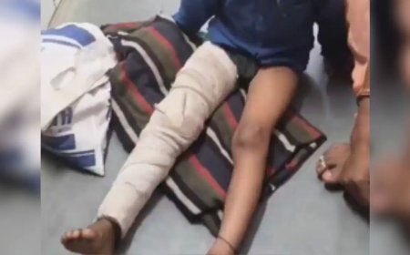 छतरपुर में मासूम छात्र से मारपीट: बैग न लाने पर शिक्षक ने पैर तोड़ा, FIR दर्ज