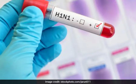 डेंगू के 76 और चिकनगुनिया के 6 मरीज पहुंचे, स्वास्थ्य विभाग ने तेज किया लार्वा सर्वे अभियान