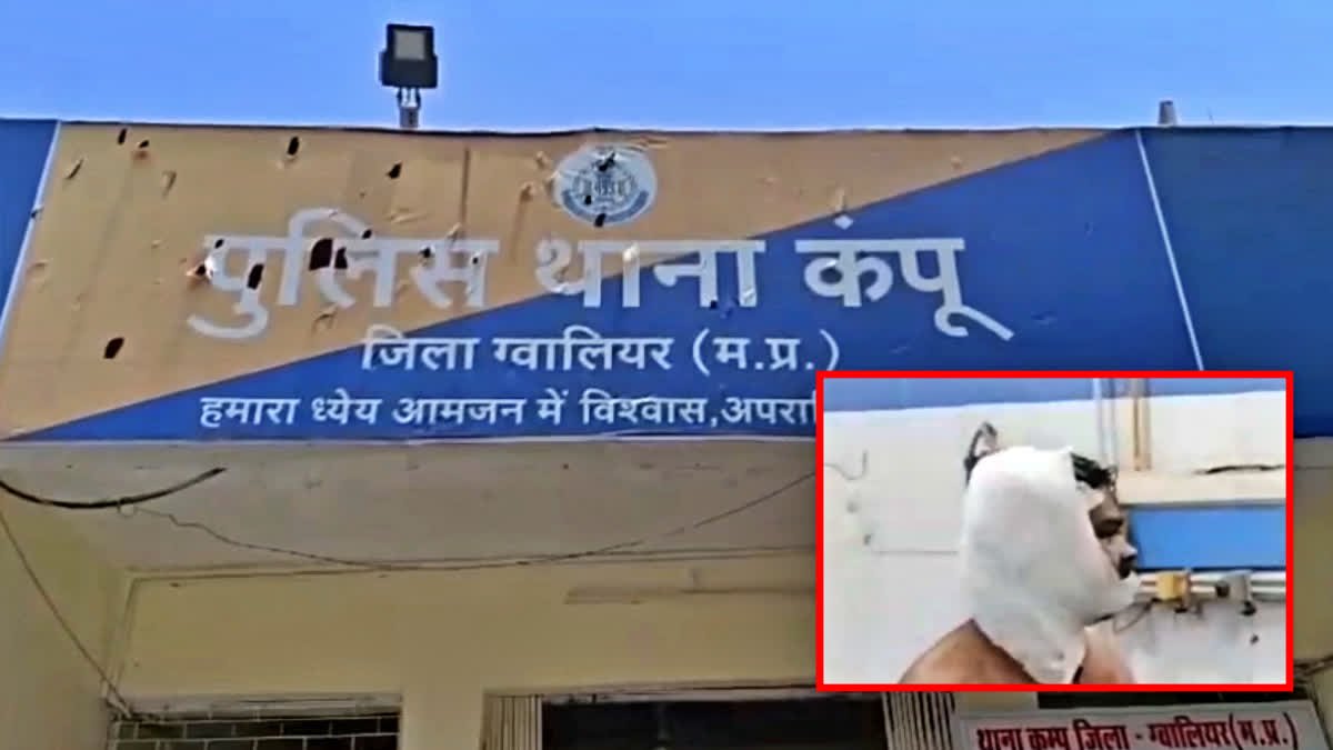 ग्वालियर में प्रेमिका के खौफनाक हमले से सनसनी, शादीशुदा जिंदगी में दखल से नाराज होकर उठाया खूनी कदम