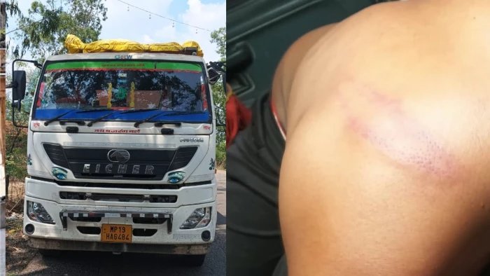 ट्रक के नीचे श्वान आने पर विवाद, बंदूकधारियों पर चालक के साथ मारपीट और पुलिस पर अनदेखी का आरोप