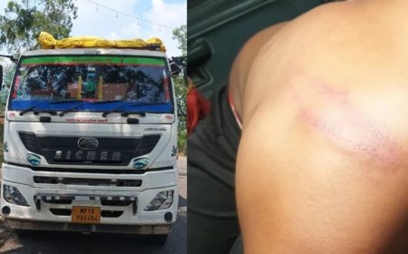 ट्रक के नीचे श्वान आने पर विवाद, बंदूकधारियों पर चालक के साथ मारपीट और पुलिस पर अनदेखी का आरोप