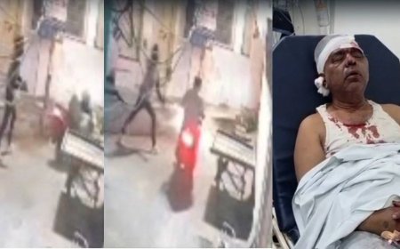 कटनी में डेयरी कारोबारी पर आदतन अपराधी का जानलेवा हमला, सिर पर पत्थर से 15 बार वार कर सोने की चेन लूटी