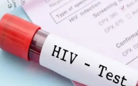 गिरफ्तारी के दौरान आरोपी ने पुलिस आरक्षक को काटा, ब्लड टेस्ट में निकला HIV पॉजिटिव- मचा हड़कंप